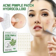 JAYSUING Acne Pimple Patch box with 144 beige hydrocolloid patches displayed on right side