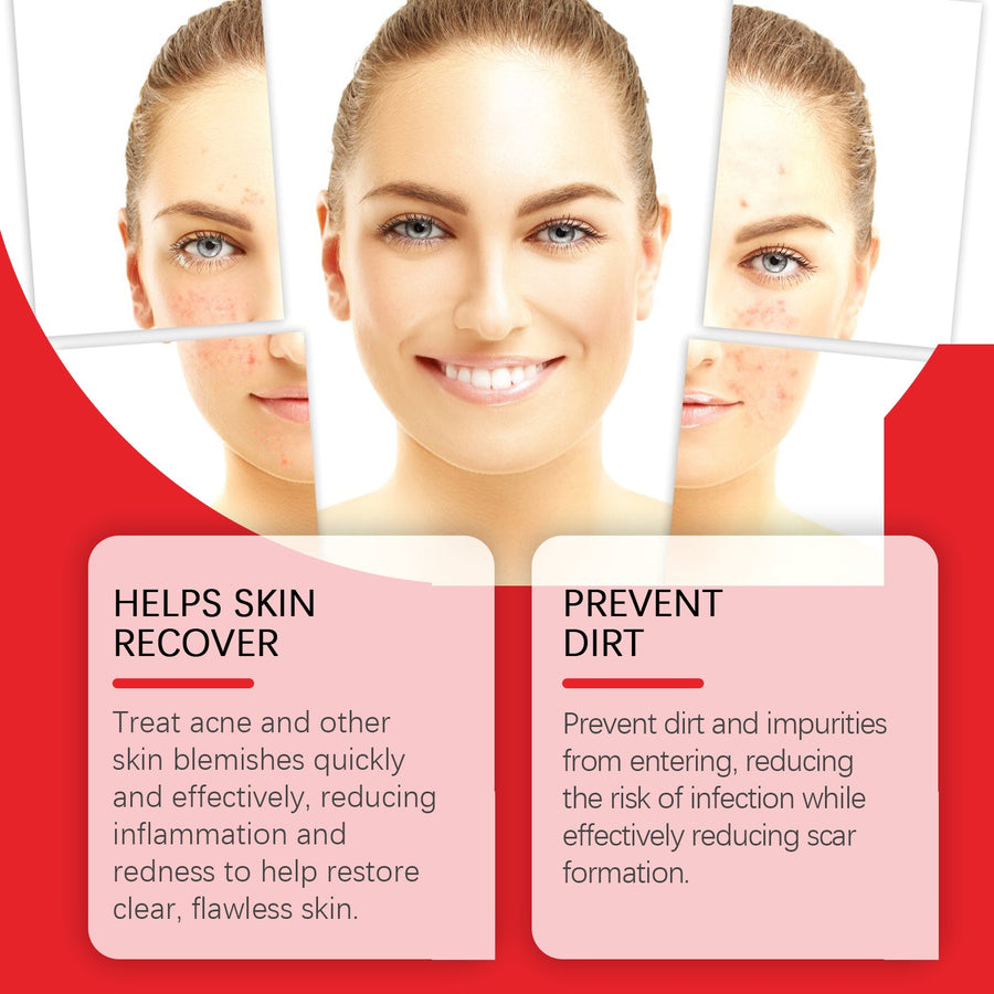 Acne Patches, Star-Shaped Overnight Blemish Coverage