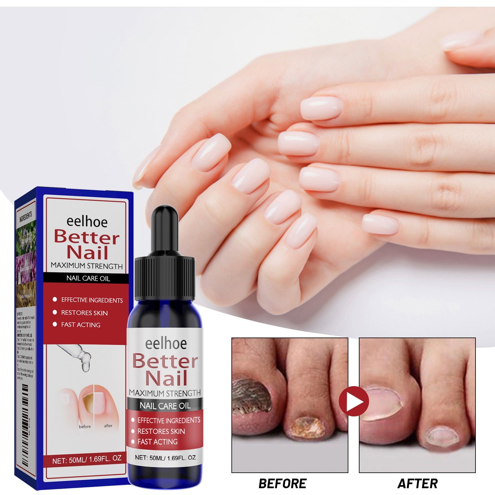 Woman's hands overlapping in relaxed pose showing perfectly manicured pale pink and white ombre nails; small before/after comparison panels bottom right showing fungal nail treatment results