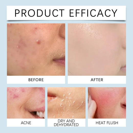 Hyaluronic Acid Face Serum for Hydrated, Smooth Skin