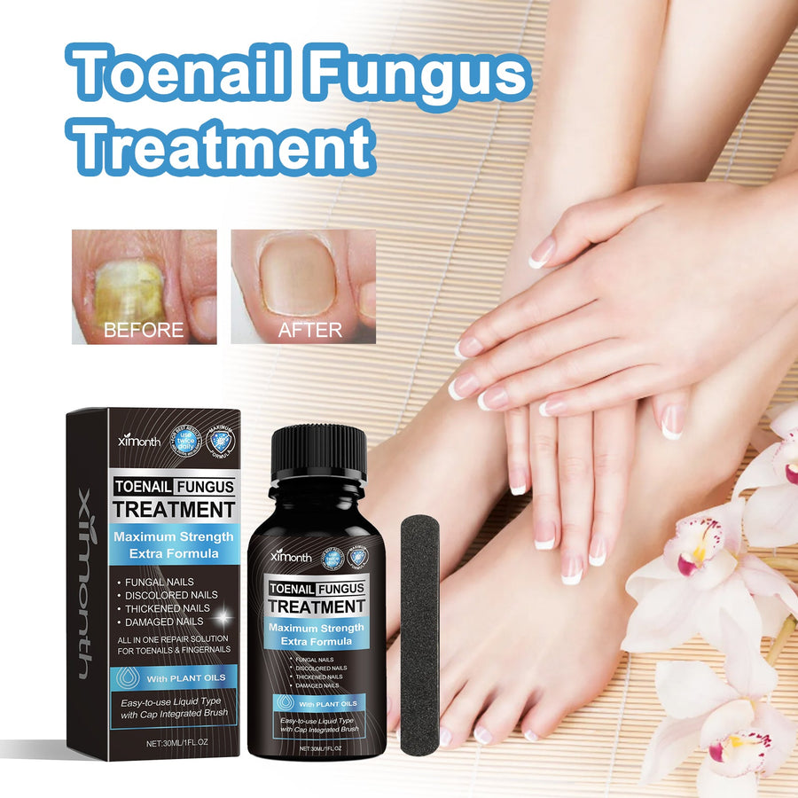 Toenail Fungus Treatment — Maximum Strength Repair