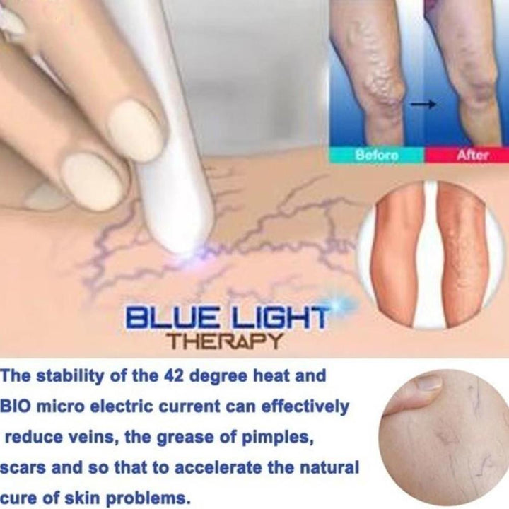 Spider Vein Eraser Anti-varicose Veins Removal Pen Blue/Red