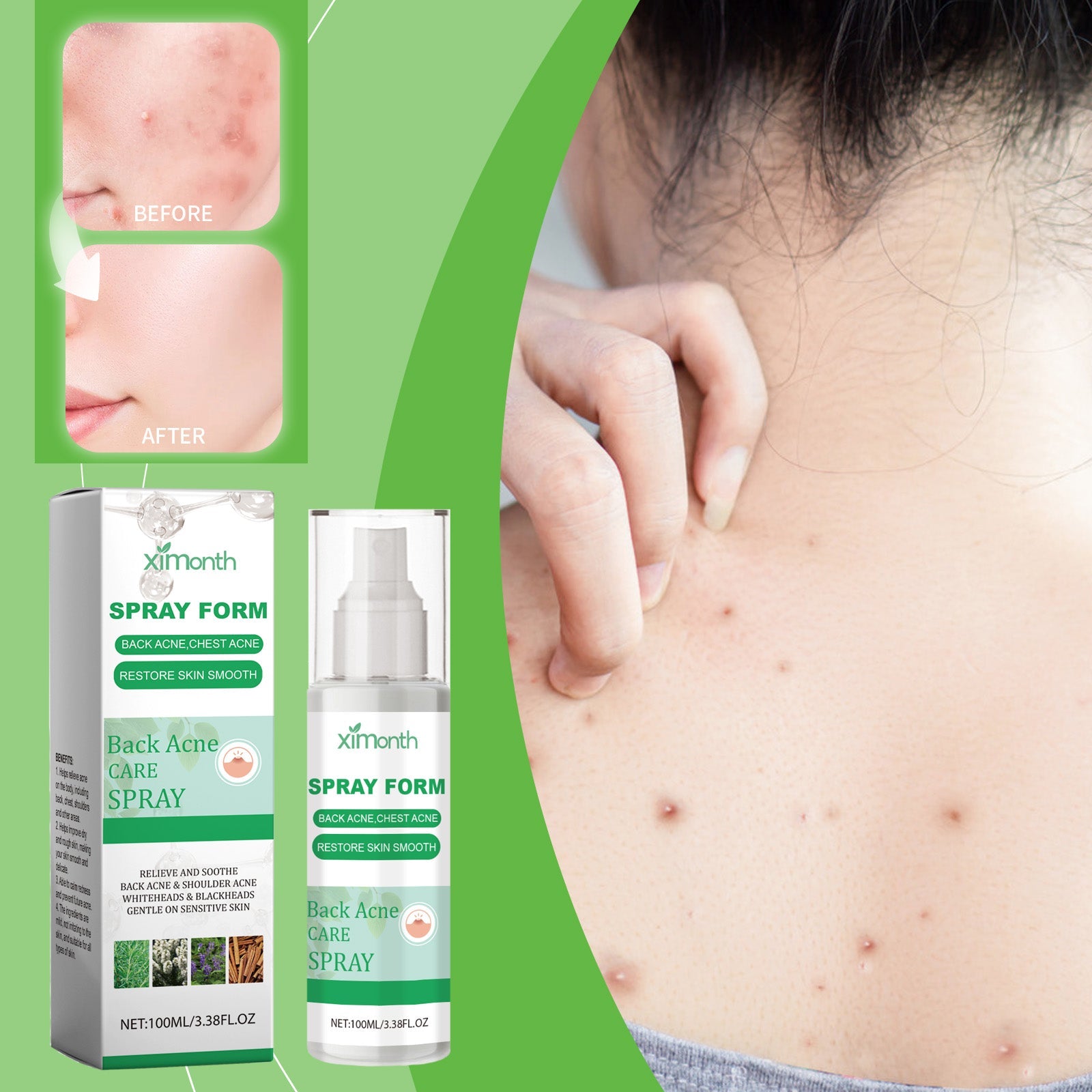 Back view of person showing back acne coverage with herbal leaf accents and product bottles, benefit callouts for refreshing comfort and acne relief