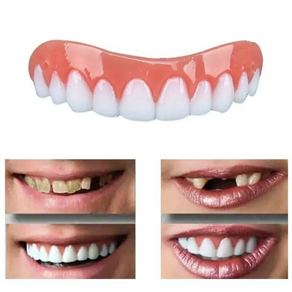 Instant Smile False Teeth — Perfect Smile, No Dentist Needed