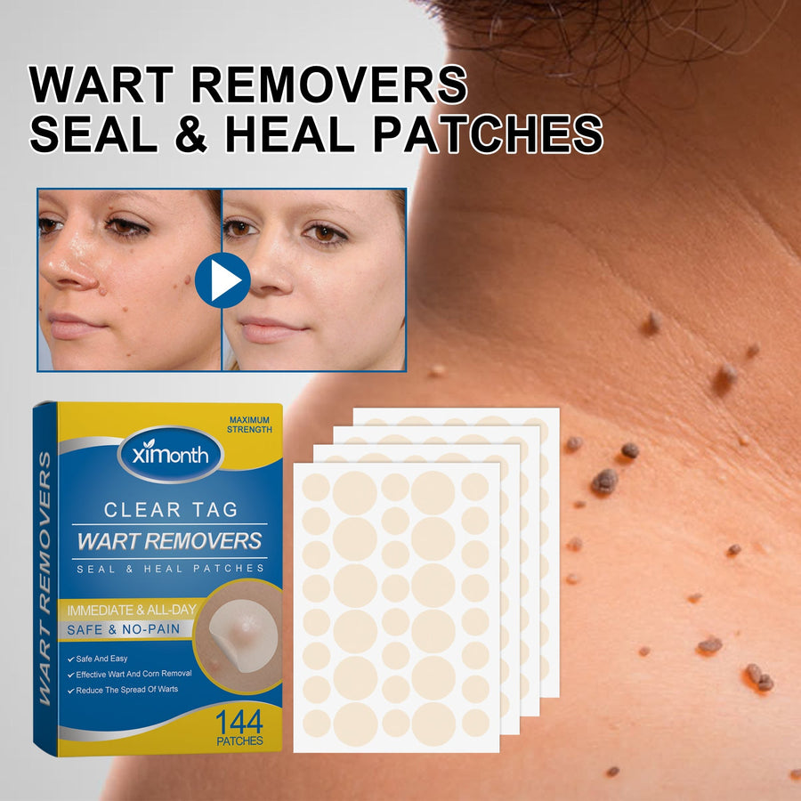 Wart Removal Patches — Safe, Painless 144‑Patch Maximum