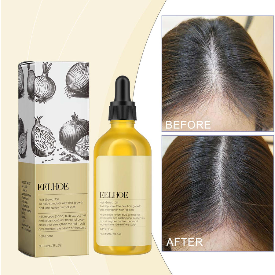 Red Onion Hair Oil for Fuller-Looking, Nourished Hair