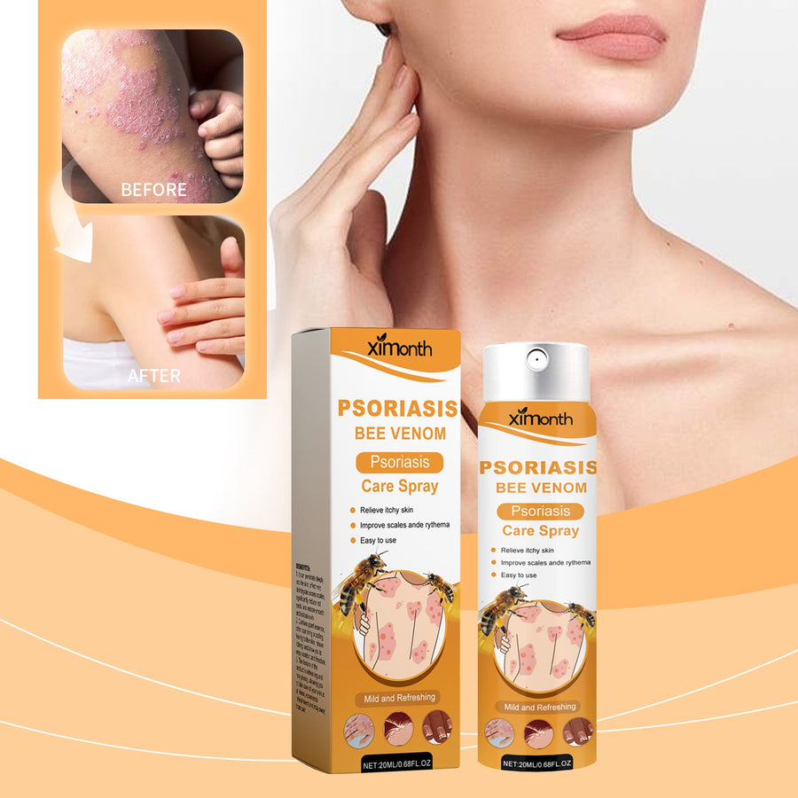 Bee Venom Psoriasis Spray for Itch and Redness Relief