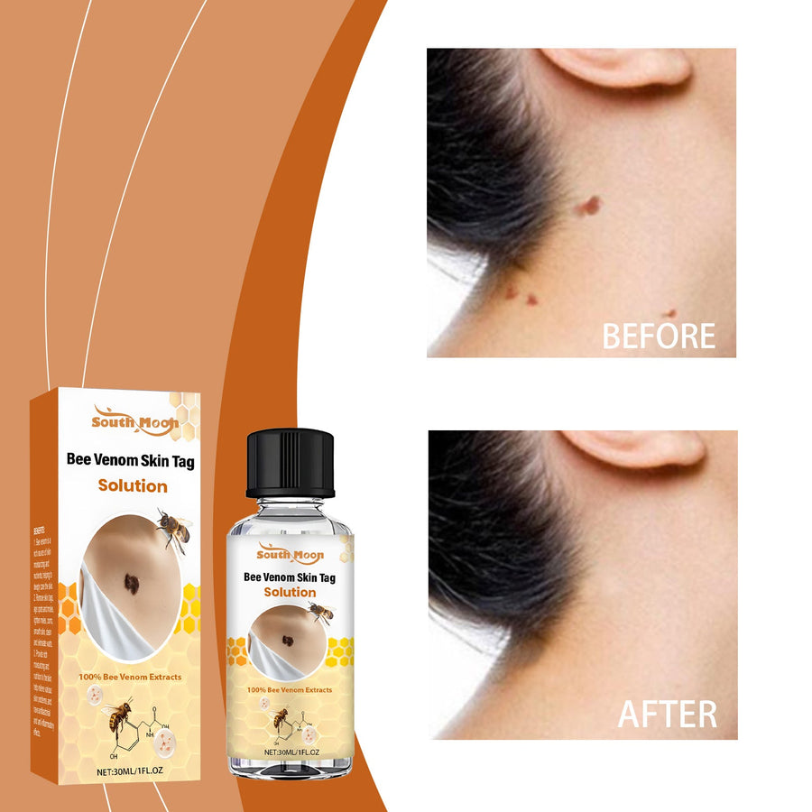 Bee Venom Skin Tag Serum for Smooth, Clear Skin