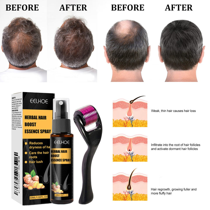 Herbal Scalp Spray & Roller for Dry, Thinning Hair