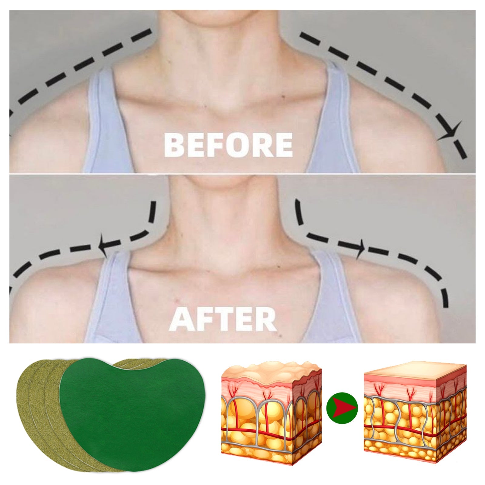 Multiple before/after images of women wearing white/pink tank tops showing upper back and shoulder area transformation
