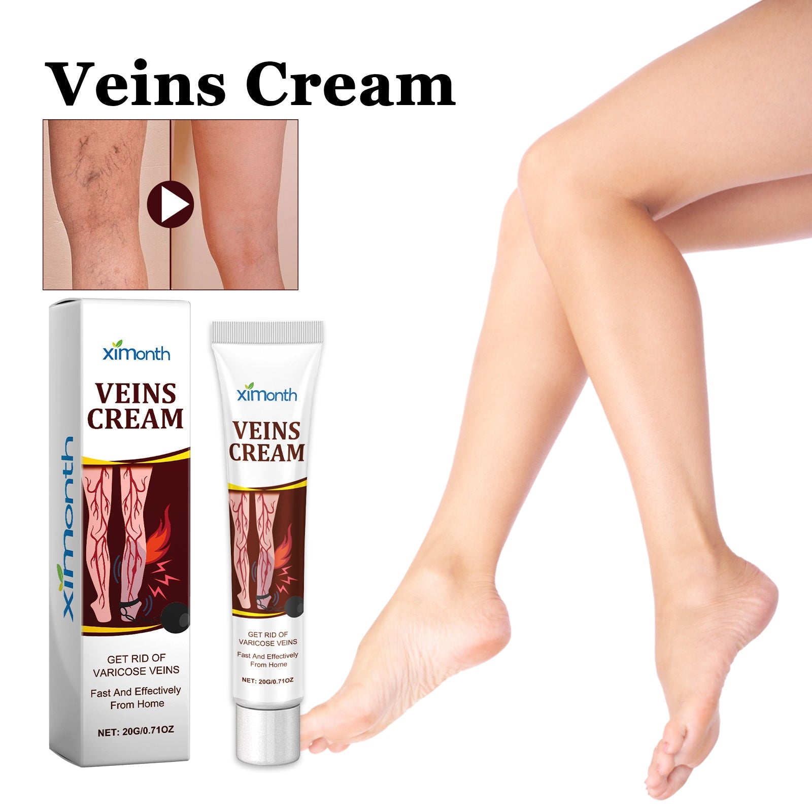 Educational infographic showing varicose vein symptoms: swelling, pain, protruding veins, and numbness with detailed leg illustrations