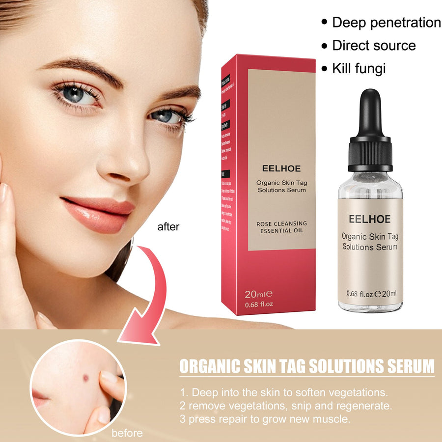 Organic Skin Tag Removal Serum – Clear, Smooth Skin in Weeks