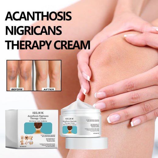Acanthosis Nigricans Cream for Dark Underarms & Creases