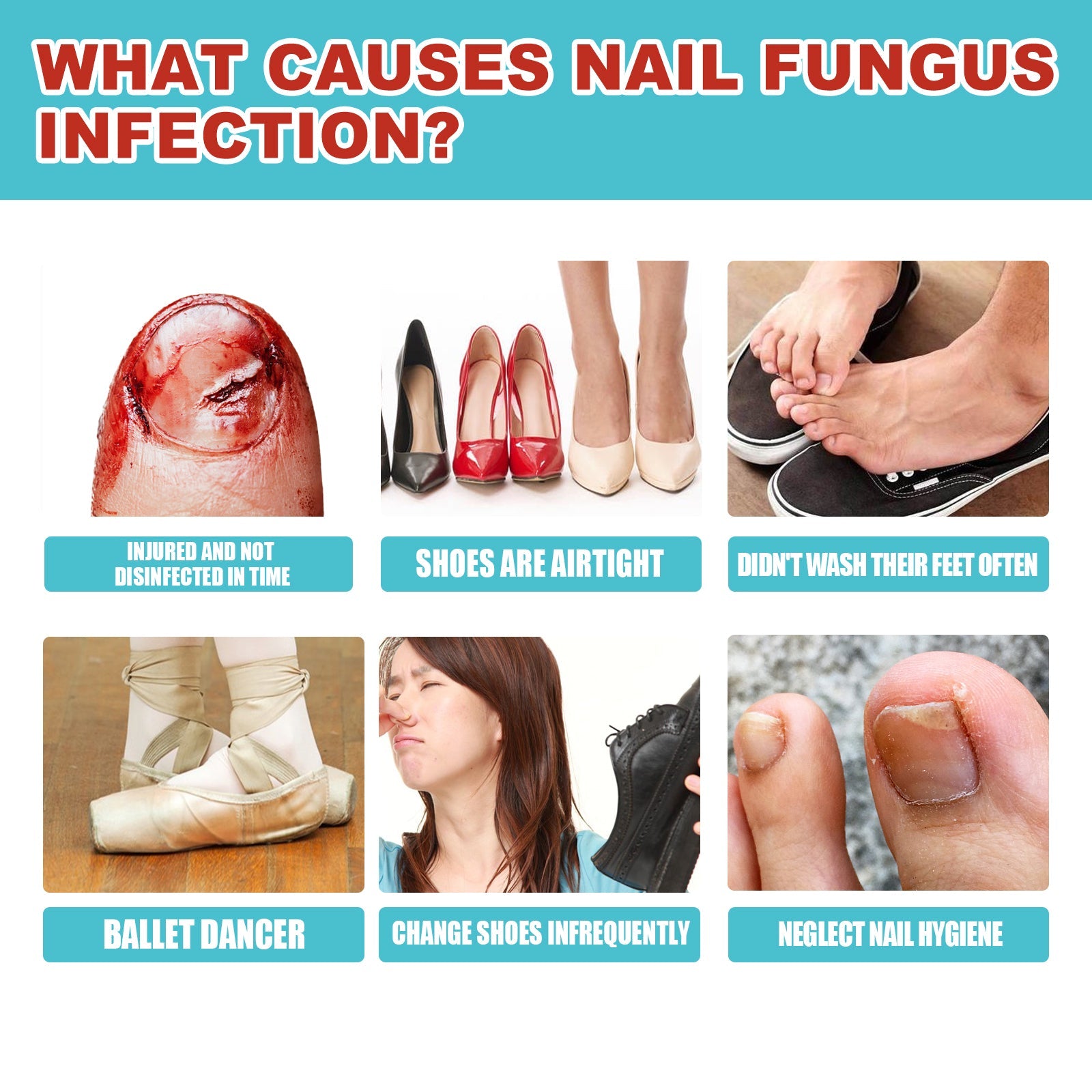 Medical cross-section diagram and before/after nail photos with fungal infection classification
