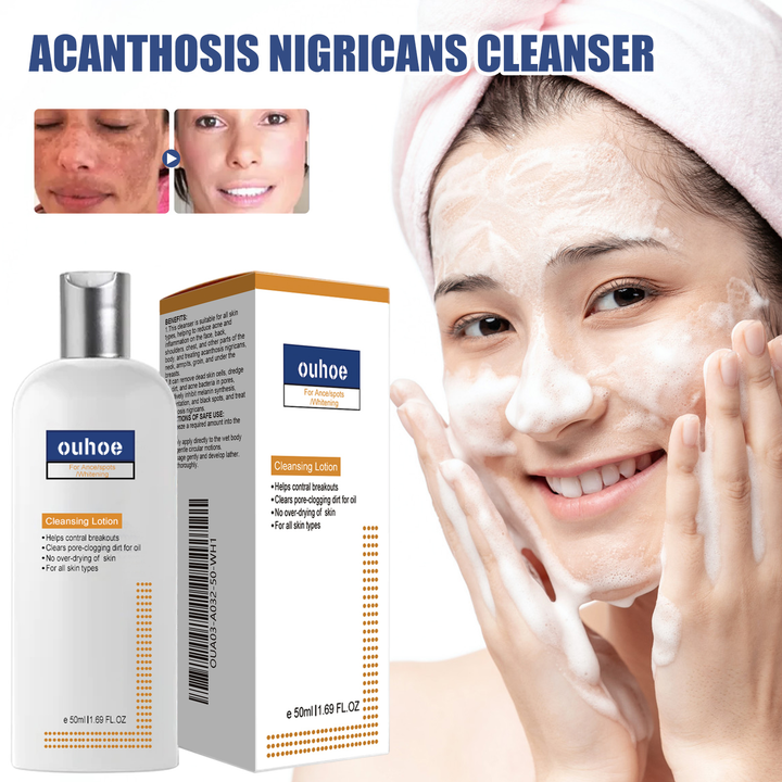 Acanthoderm Face Cleanser for Oily, Breakout-Prone Skin