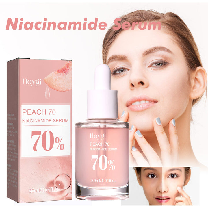 Niacinamide 70% Serum for Pores, Spots & Dull Skin