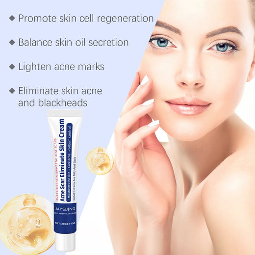 Acne Clearing Cream for Oily, Blemish-Prone Skin