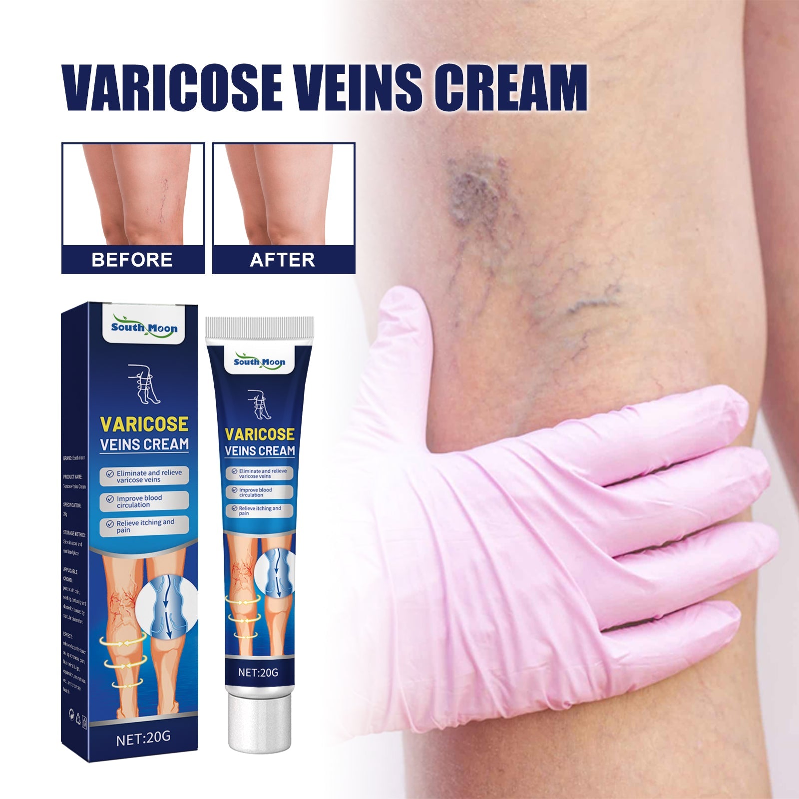 Before and after leg comparison showing visible vein reduction