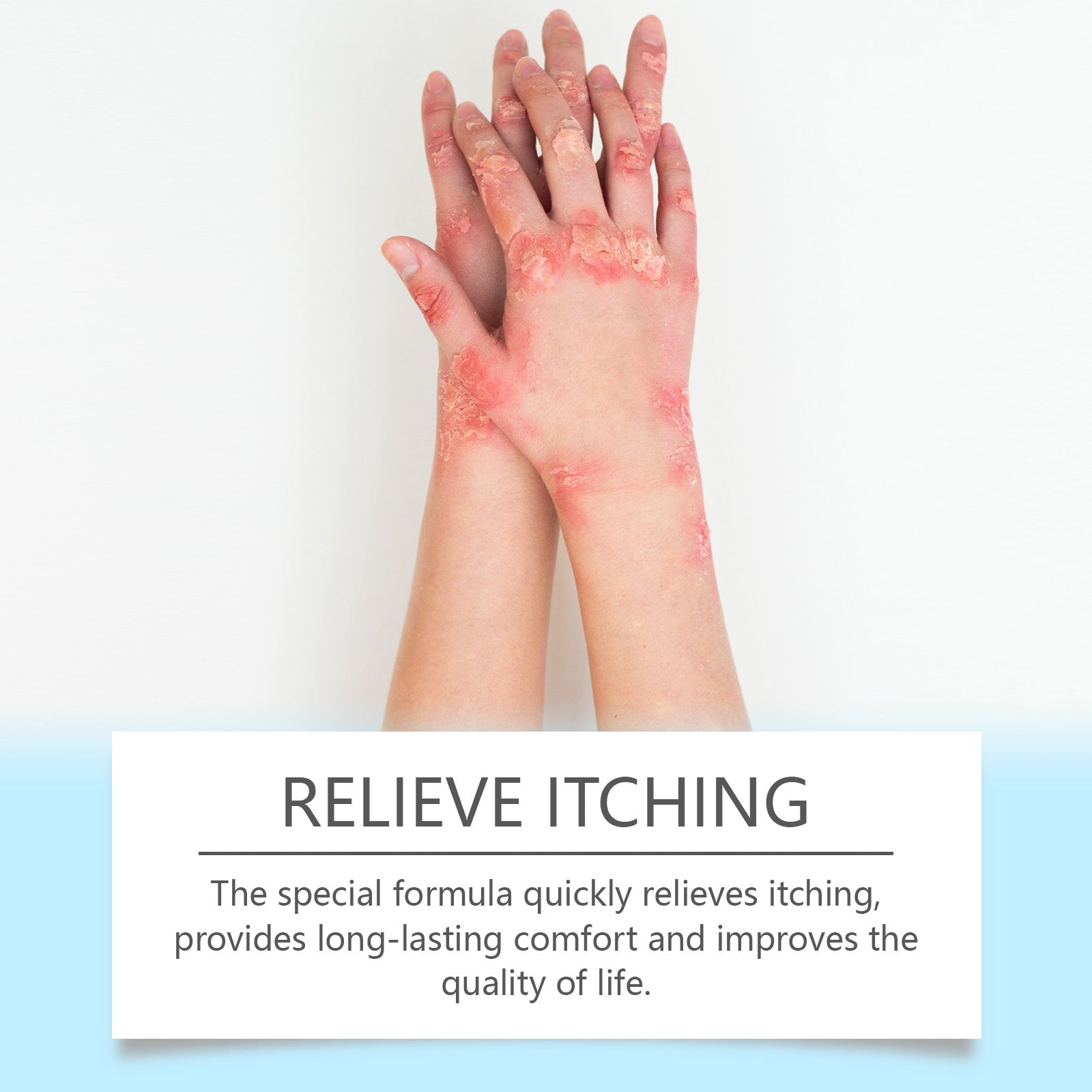 Child's arm showing lighter, less severe fungal patches with hand applying or touching treated area; dual benefit callouts for Deep Nourishment and Reduce Redness and Swelling