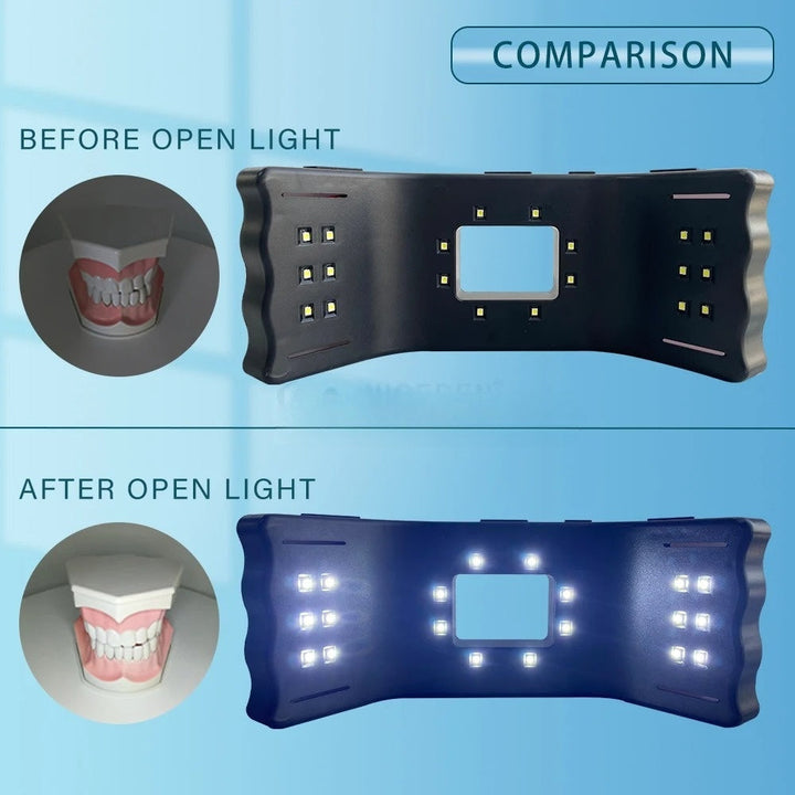 Dental LED Fill Light — Shadow‑Free Smartphone Oral