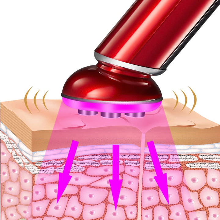 RF & LED Facial Lifting Device — Firm Skin in 5 Min Daily