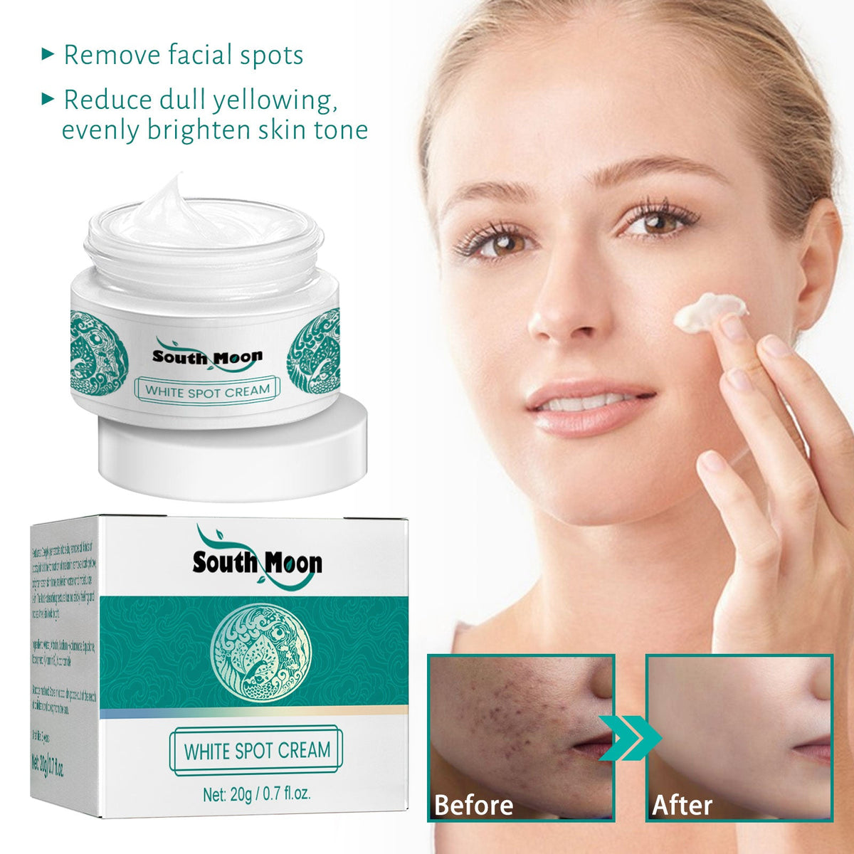 Dark Spot Cream for Face - Fades Freckles & Brightens
