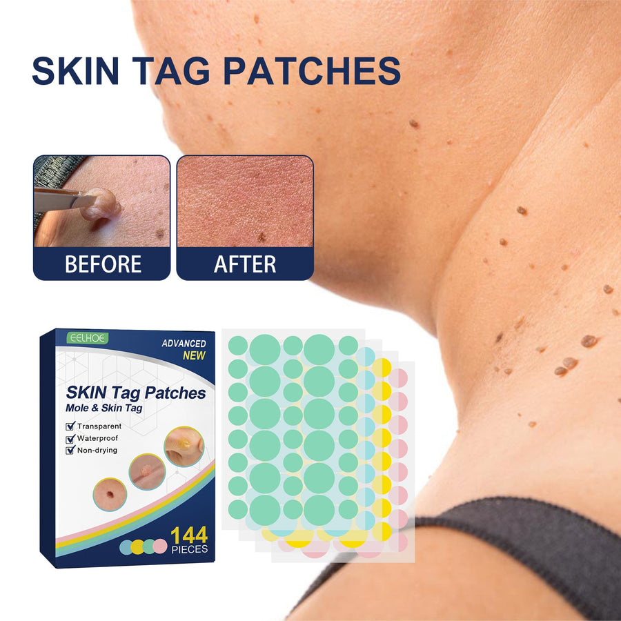 Skin Tag & Mole Removal Patches — 144 Waterproof Patches