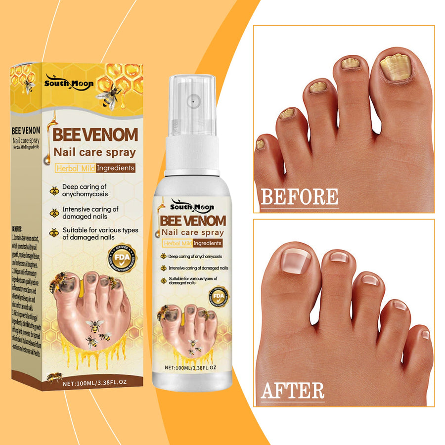 Bee Venom Nail Spray for Fungal Nail Damage Relief