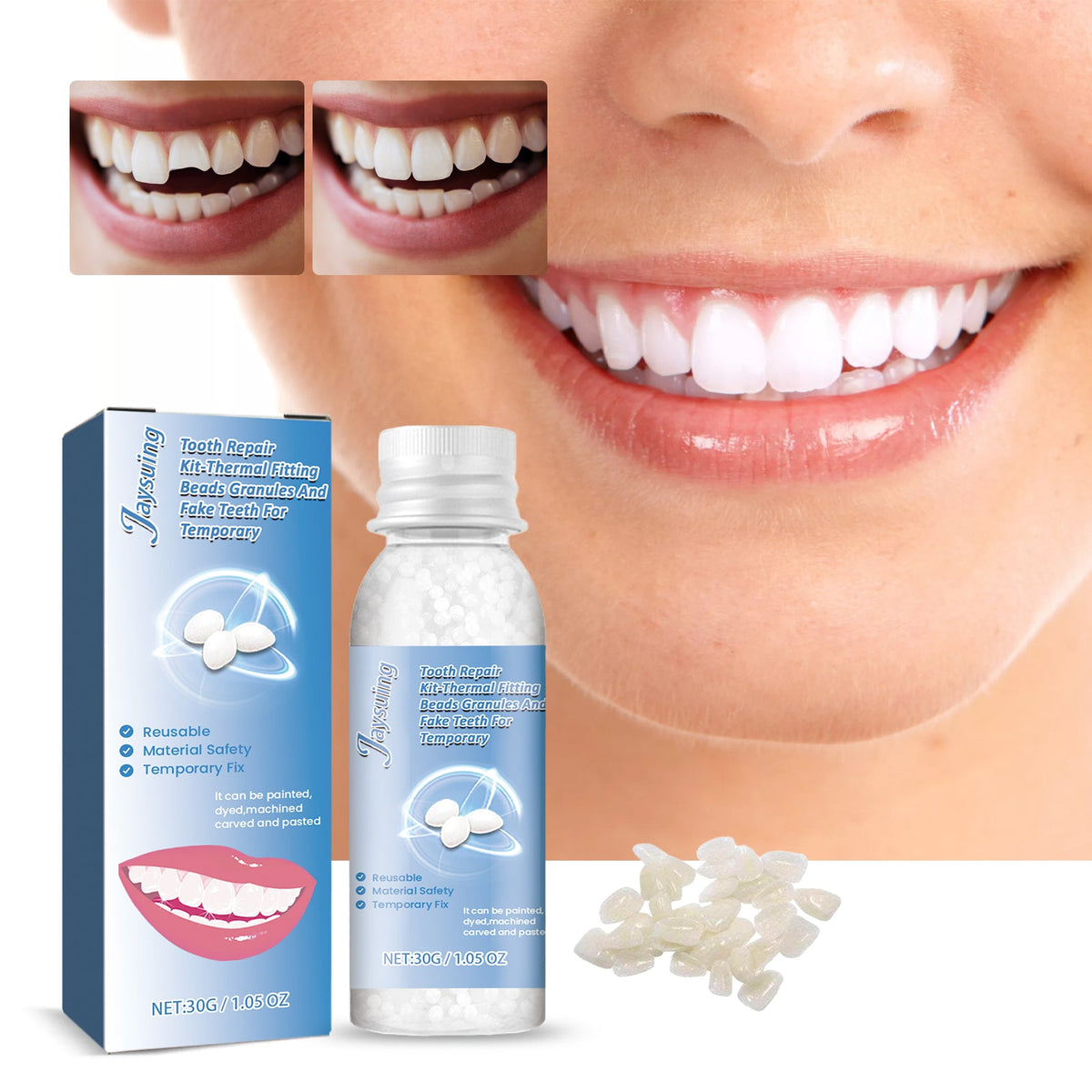 Tooth Repair Kit — Instant Smile Fix with Moldable Beads