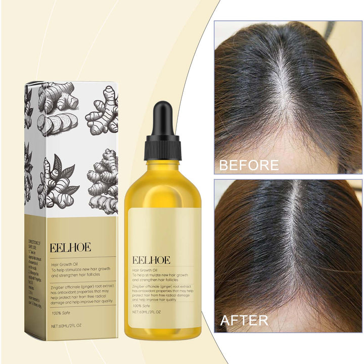 Ginger Hair Growth Oil for Targeted Scalp Care