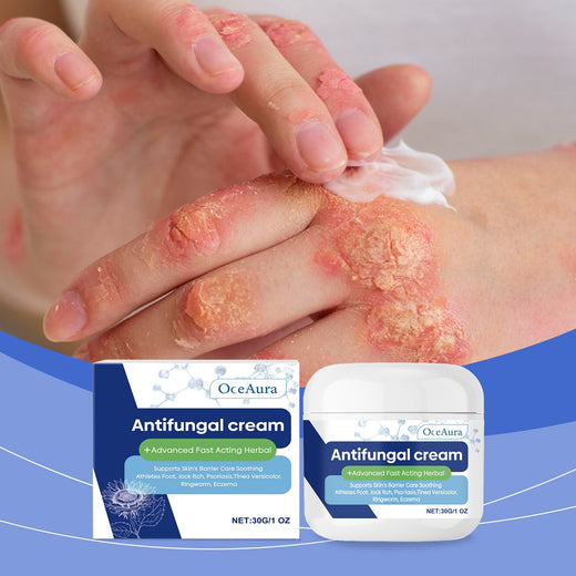 Herbal Antifungal Skin Repair Cream for Itching & Redness