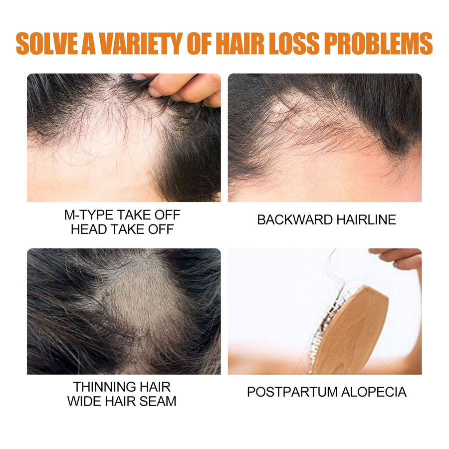 Minoxidil Hair Growth Spray for Men | 5% Treatment