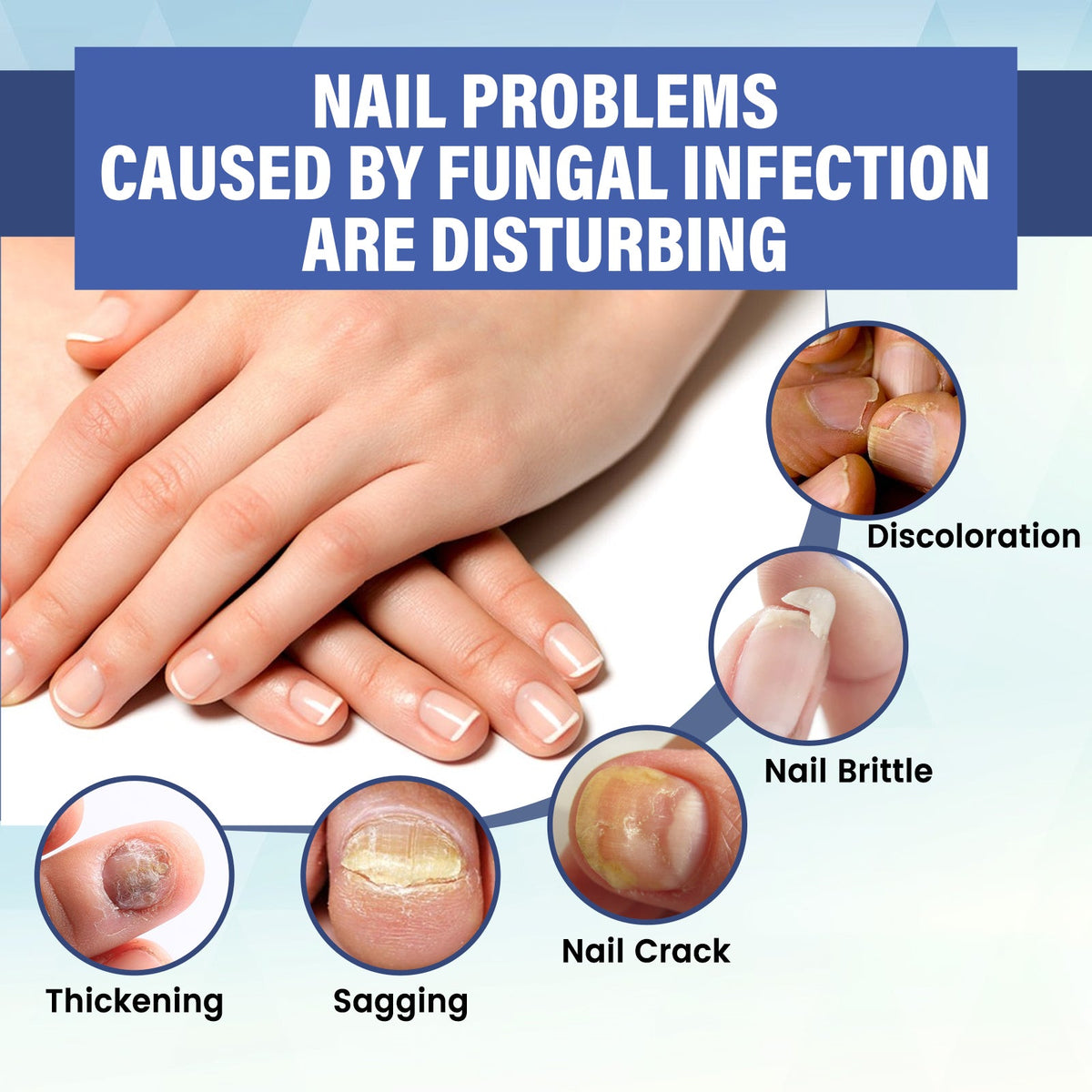 LED Nail Repair Treatment — Clear Fungus & Restore Nail