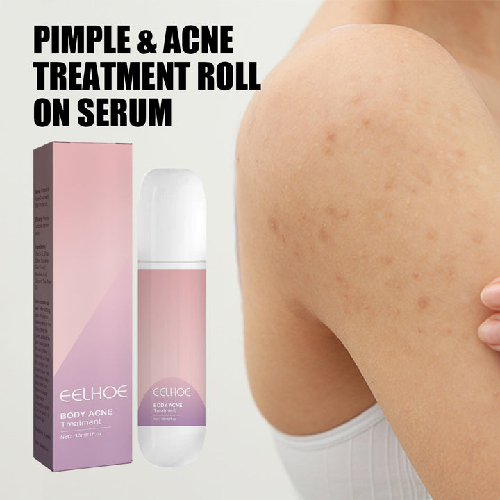 Body Acne Roll-On Serum for Back, Chest & Neck
