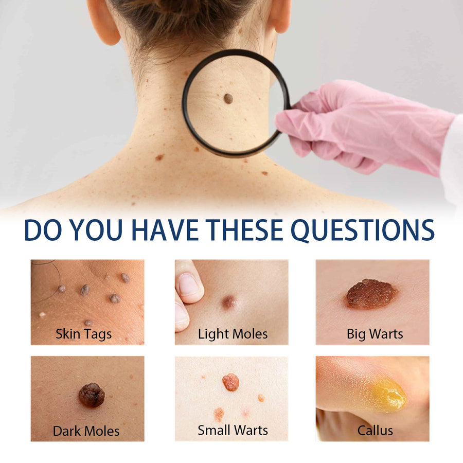 Wart Repair Kit for At-Home Spot Treatment Care
