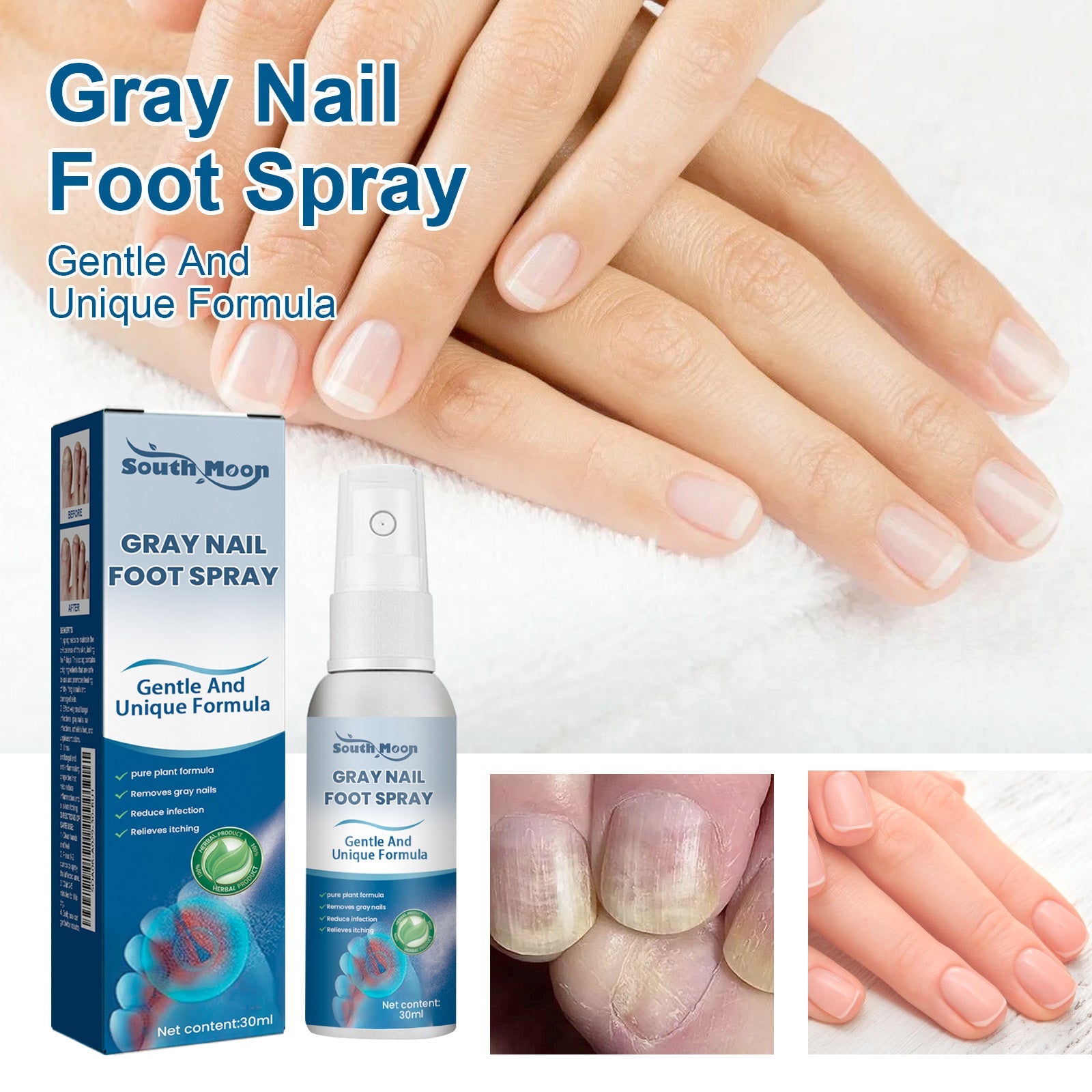 Lifestyle image showing healthy, pink nails on feminine hands next to before images of gray/infected nails, with product bottle and box featured