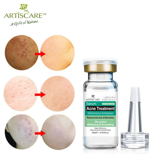 Acne Scar Serum for Blemish-Prone Skin, 10ml Travel