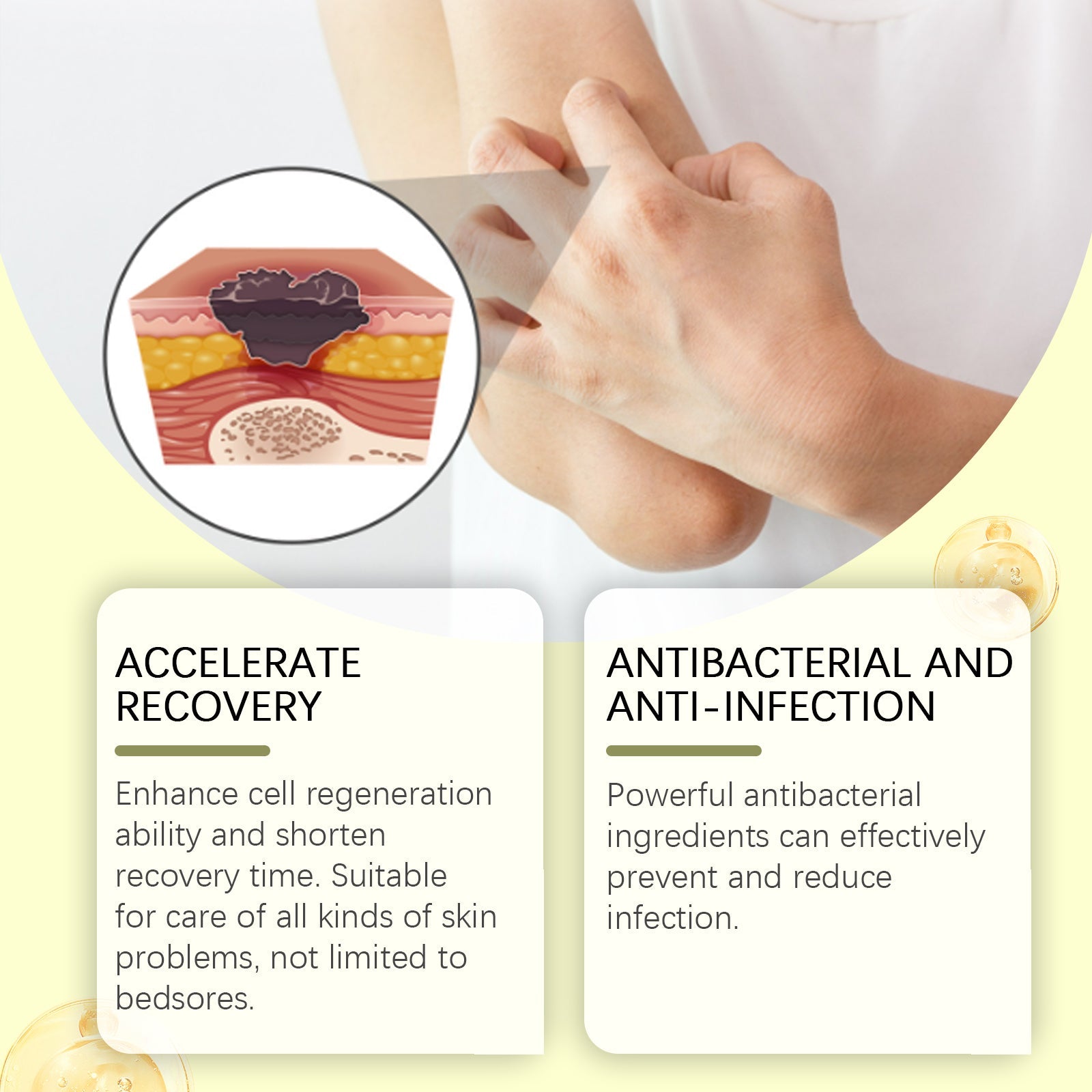 Anatomical cross-section diagram of skin layers with wound illustration, flanked by benefit claims: Accelerate Recovery and Antibacterial/Anti-Infection