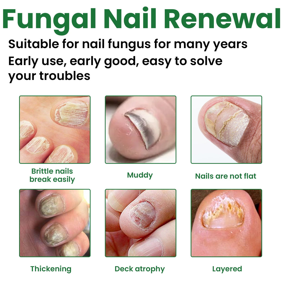 Gentle Nail Care Cream for Nails