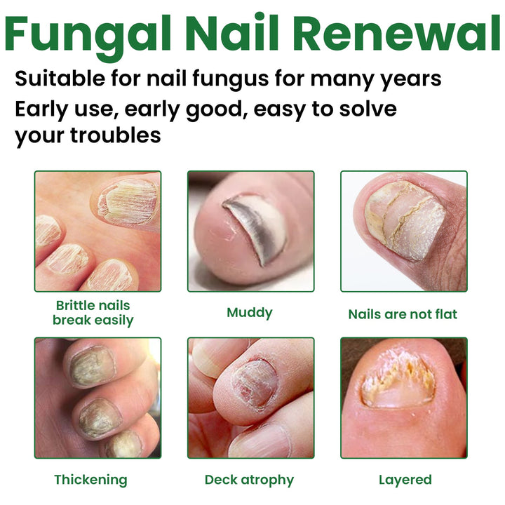 Gentle Nail Care Cream for Nails