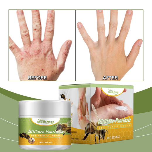 Bee Venom Cream for Psoriasis Redness & Dry Skin Relief