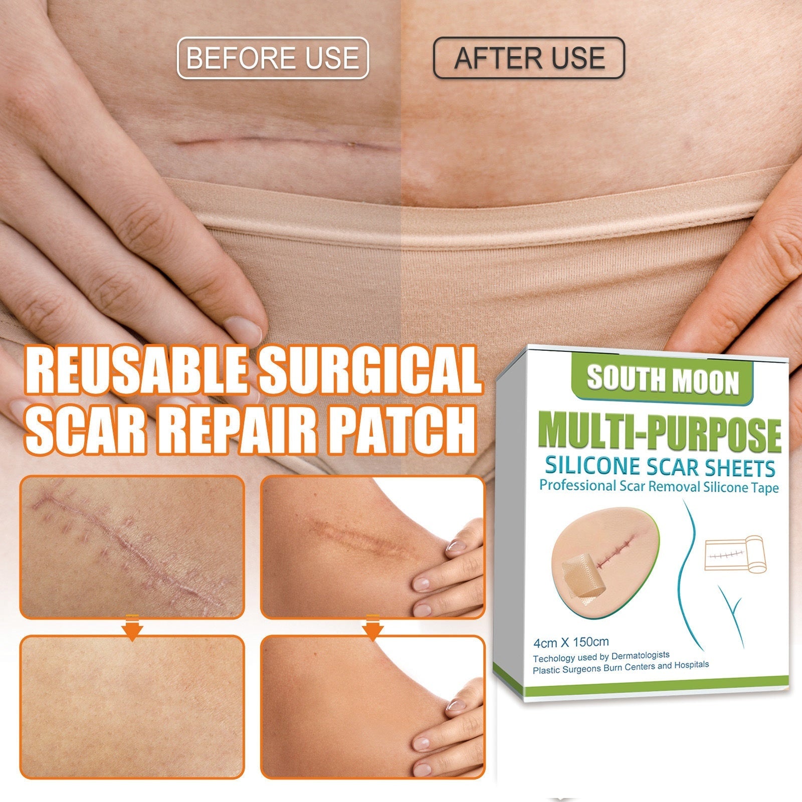 Direct before/after comparison showing significant scar improvement with labeled before/after states and grid of visual results on various scar types