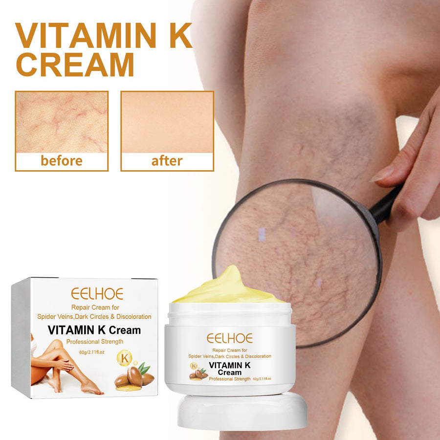 Vitamin K Cream for Spider Veins & Leg Discoloration