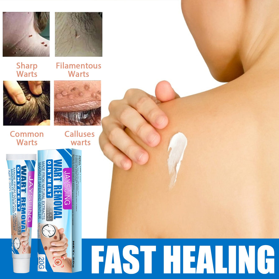 Topical Wart Removal Cream for Gentle At-Home Care