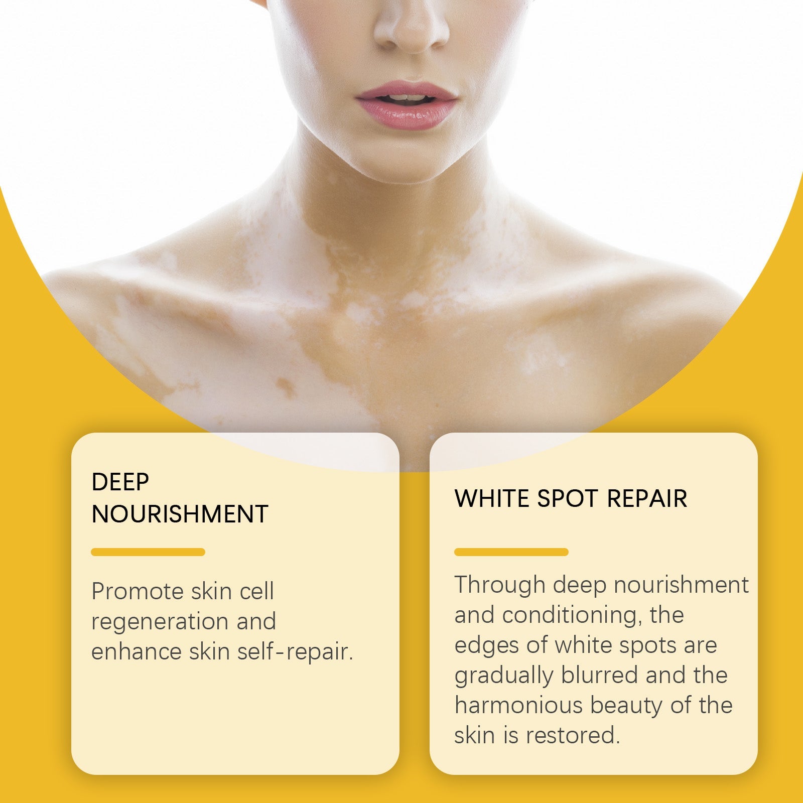 Woman shown from behind with visible white spot patches on back and shoulders, with product and packaging overlaid