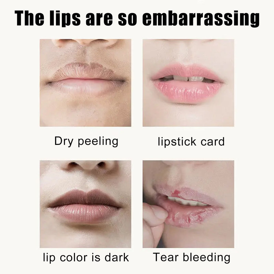 Cherry Crystal Lip Mask — Brighten Lips & Smooth Lines