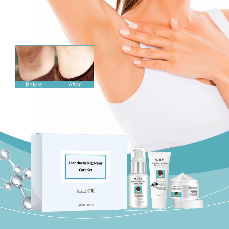 Acanthosis Nigricans Care Set for Even-Looking Skin