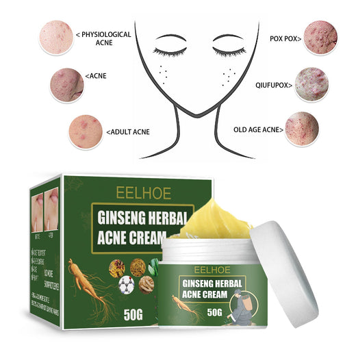 Herbal Ginseng Acne Cream — Clears Breakouts, No Scars