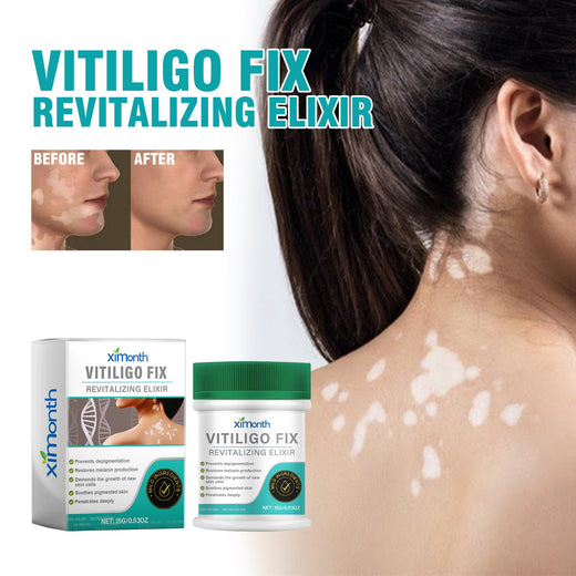 Vitiligo Fix Revitalizing Elixir, Lighten Skin Spots Even Sk