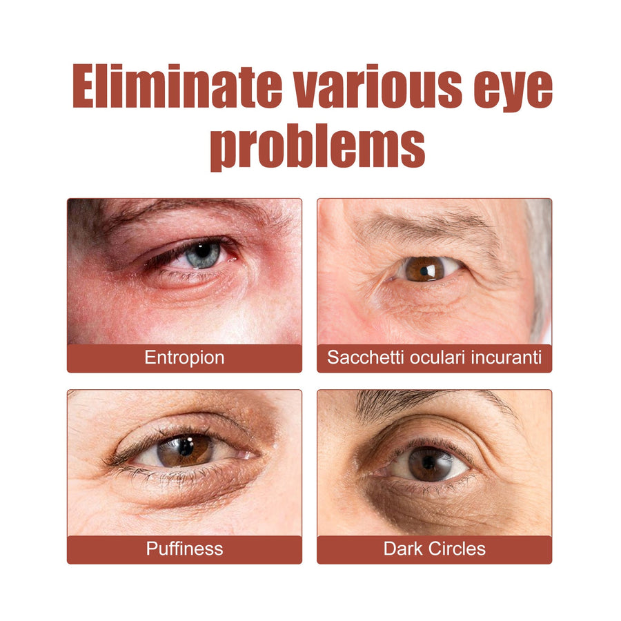 Eye Cream for Fine Lines, Bags & Dark Circle Care